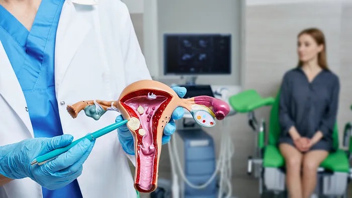 La Atonía Uterina